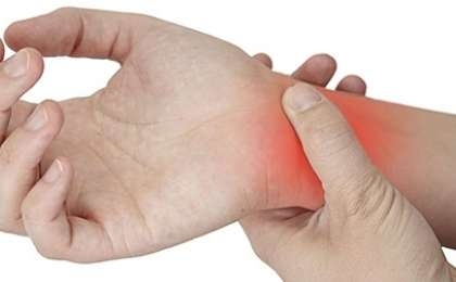 Carpal Tunnel Syndrome